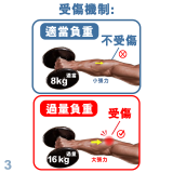 MEDEX E06b - Tennis Elbow Clasp (Universal) Cinch Device 手肘護托 | 附微調拉繩器 | 支持肌肉恢復 | 緩解關節疼痛 | 香港行貨