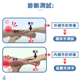 MEDEX E06b - Tennis Elbow Clasp (Universal) Cinch Device 手肘護托 | 附微調拉繩器 | 支持肌肉恢復 | 緩解關節疼痛 | 香港行貨