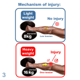 MEDEX E06b - Tennis Elbow Clasp (Universal) Cinch Device 手肘護托 | 附微調拉繩器 | 支持肌肉恢復 | 緩解關節疼痛 | 香港行貨