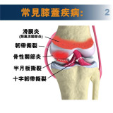 MEDEX K28 - Knee Support 膝部護托 | 關節支撐護膝 | 減輕關節壓力 | 膝蓋關節穩定 | 香港行貨