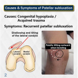 MEDEX K11b - Anti-subluxation Patellar Brace (Universal)C Shape 髕骨鬆脫護托 | 減少髕骨移位 | 提供關節穩定 | 適合術後康復 | 香港行貨